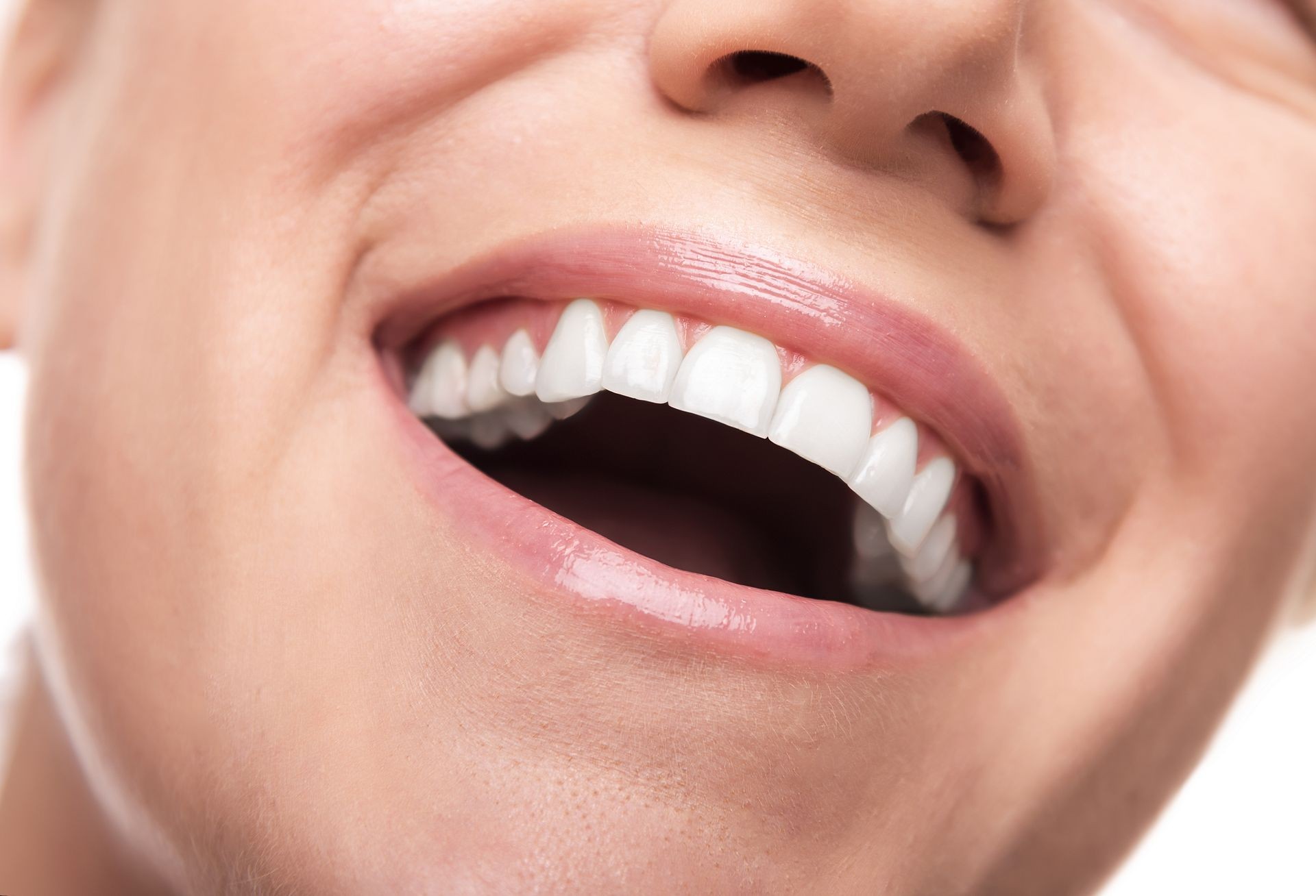 Beautiful white smile of young woman. Closeup photo.