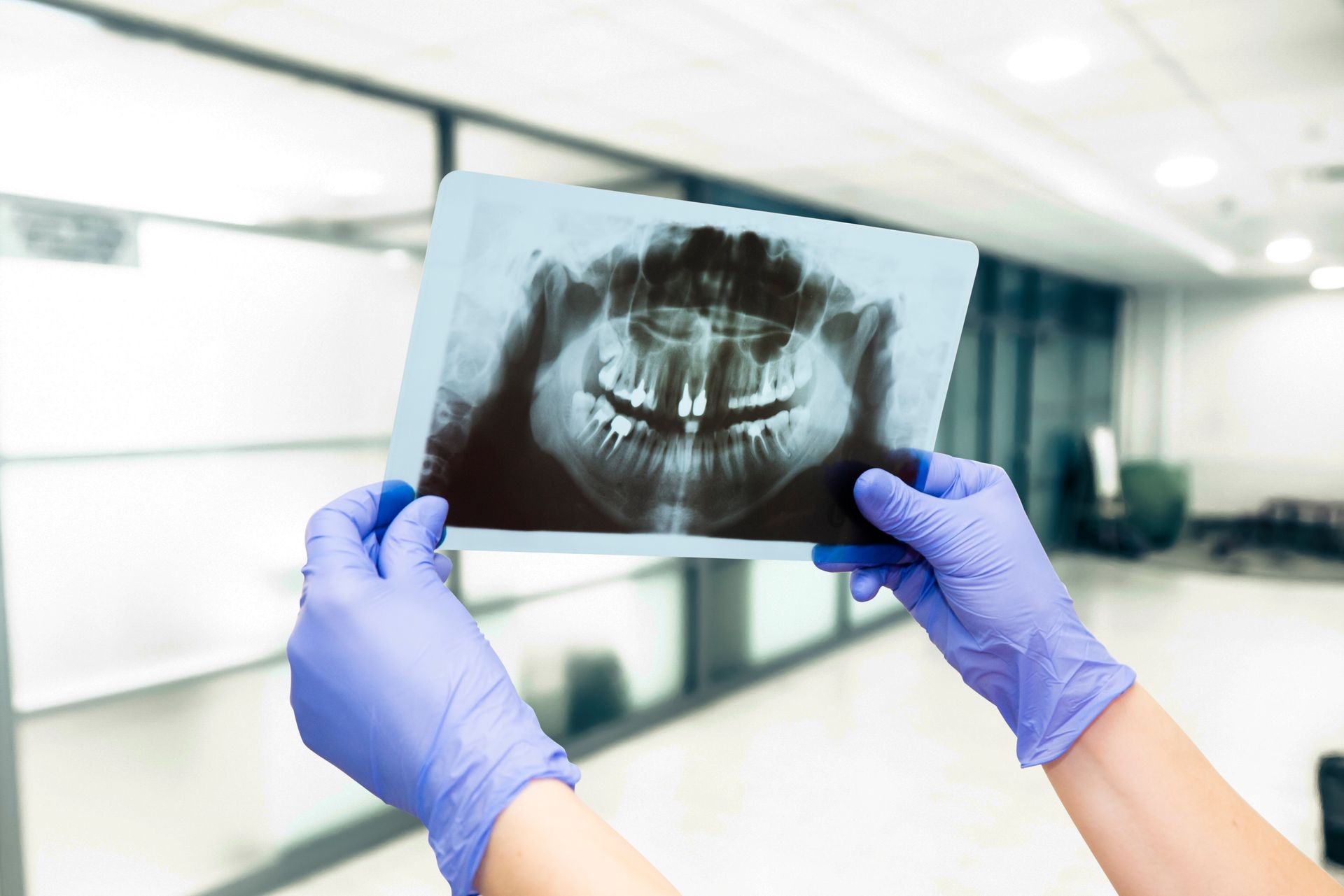 Close up of dentist hands holding X-ray image in dental office.